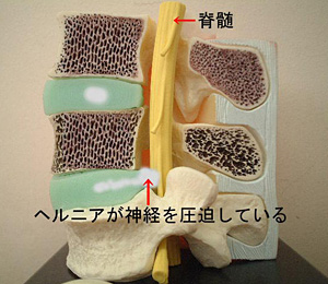 画像の説明 画像の説明